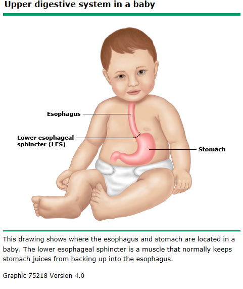 acid reflux baby