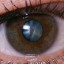 princ_rm_photo_of_close_up_of_eye